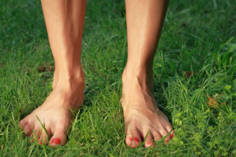 Female Feet With Vericose Veins California Vein & Vascular Centers