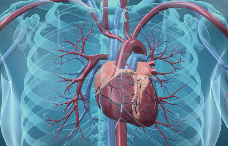 The animation of Aneurysm Symptoms in Heart at Los Altos, CA