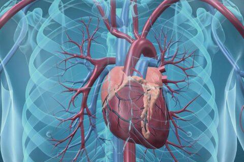 Treat Aortic Aneurysm at California Vein & Vascular Centers