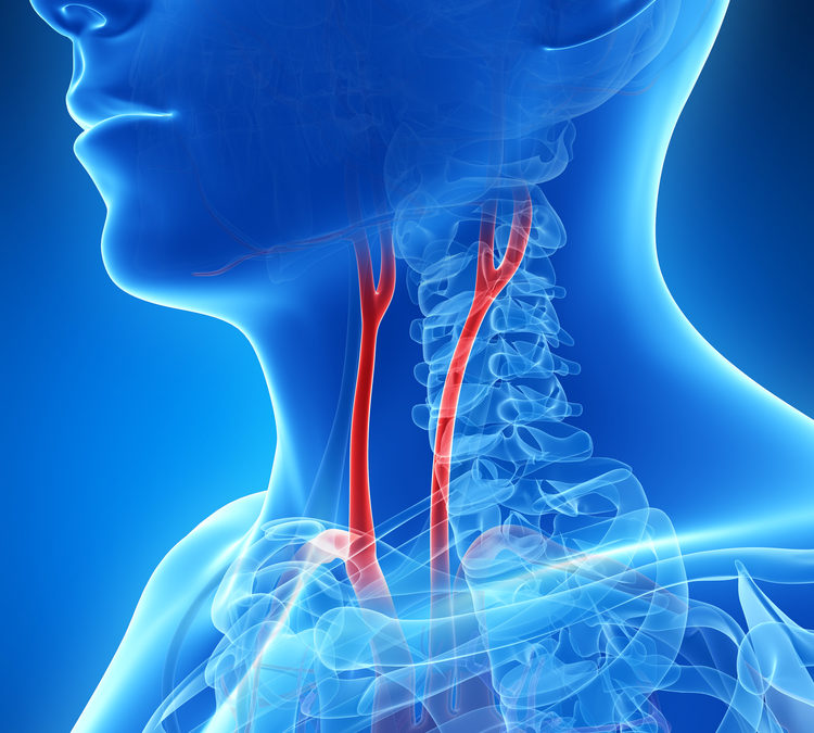 The X-ray of carotid artery in throat 