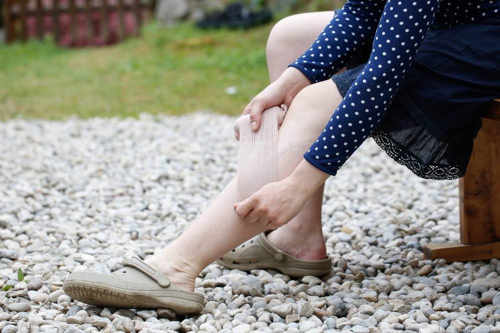 A female applying a Bandage on her leg which has spider Veins