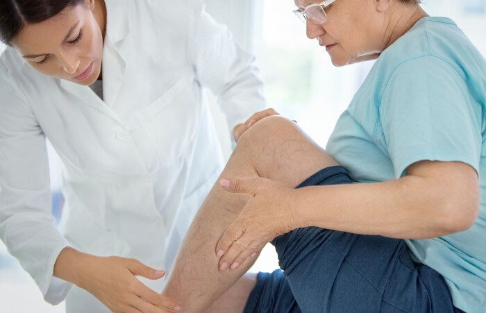 Doctor Treating Patients Venous Veins in Los Altos, Los Gatos, Morgan Hill, and Salinas, CA