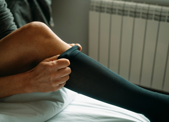 Venous Ulcer Prevention in Los Altos, Los Gatos, Morgan Hill, and Salinas, CA